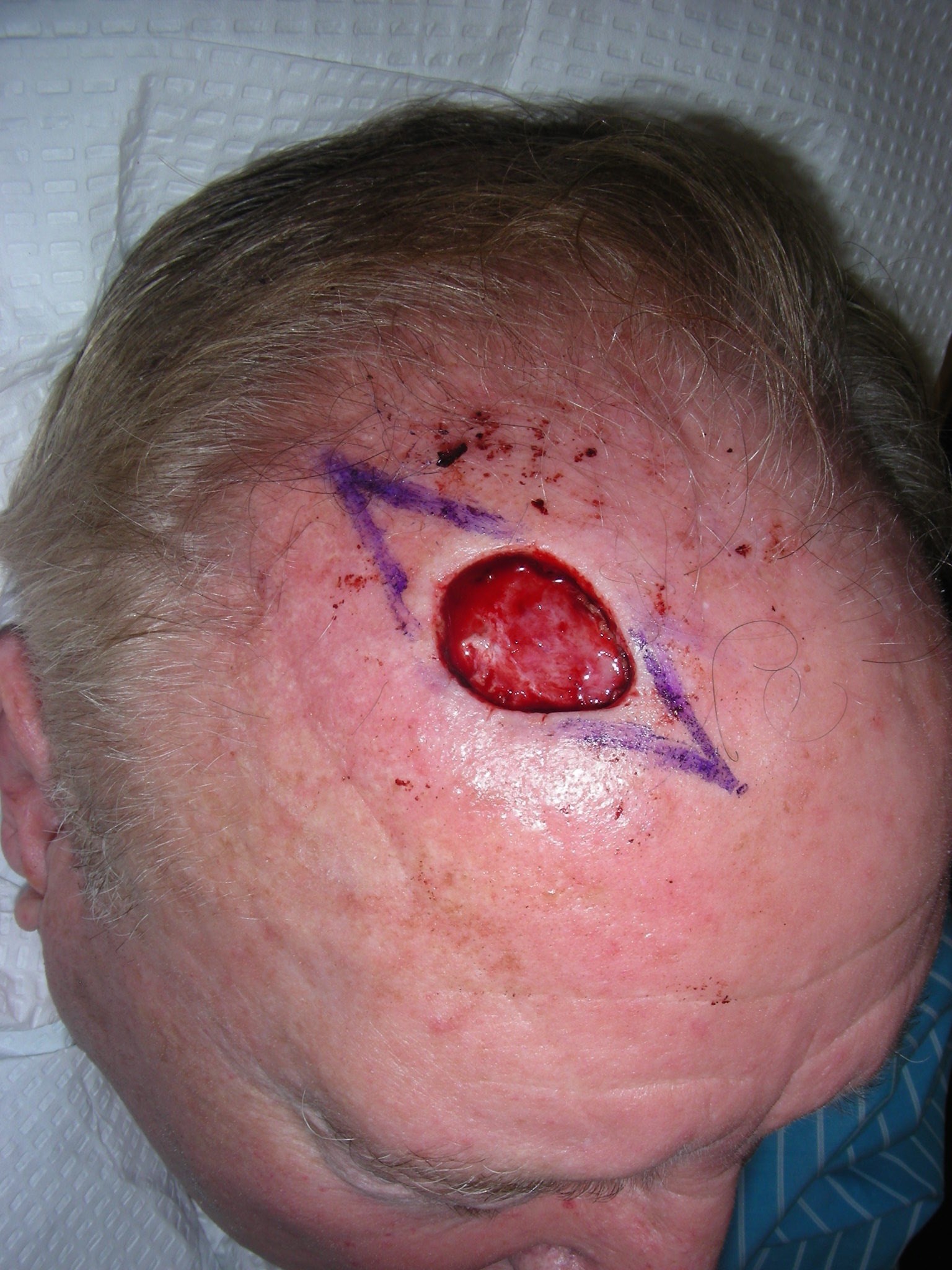 Before Image