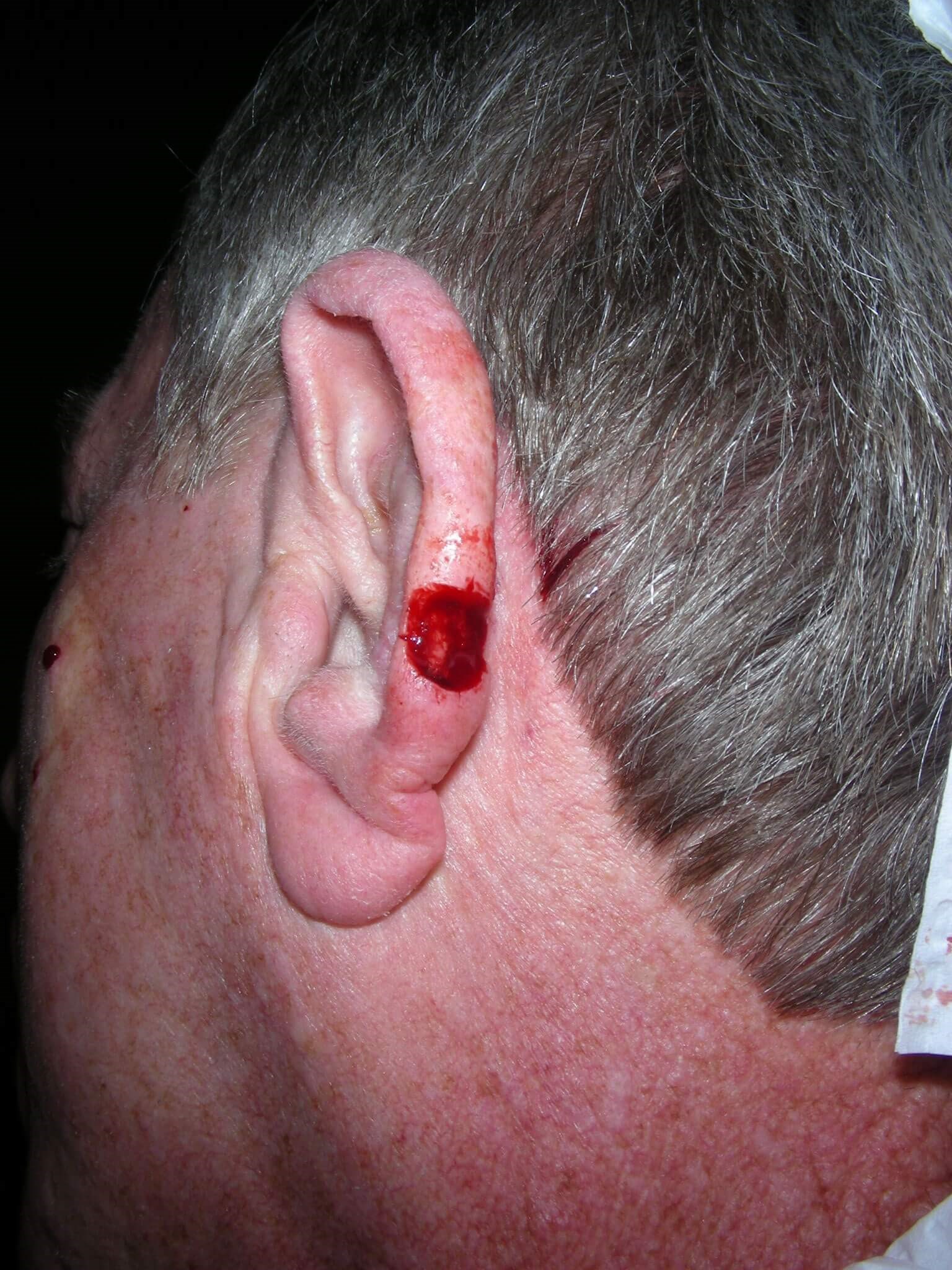 Before Image