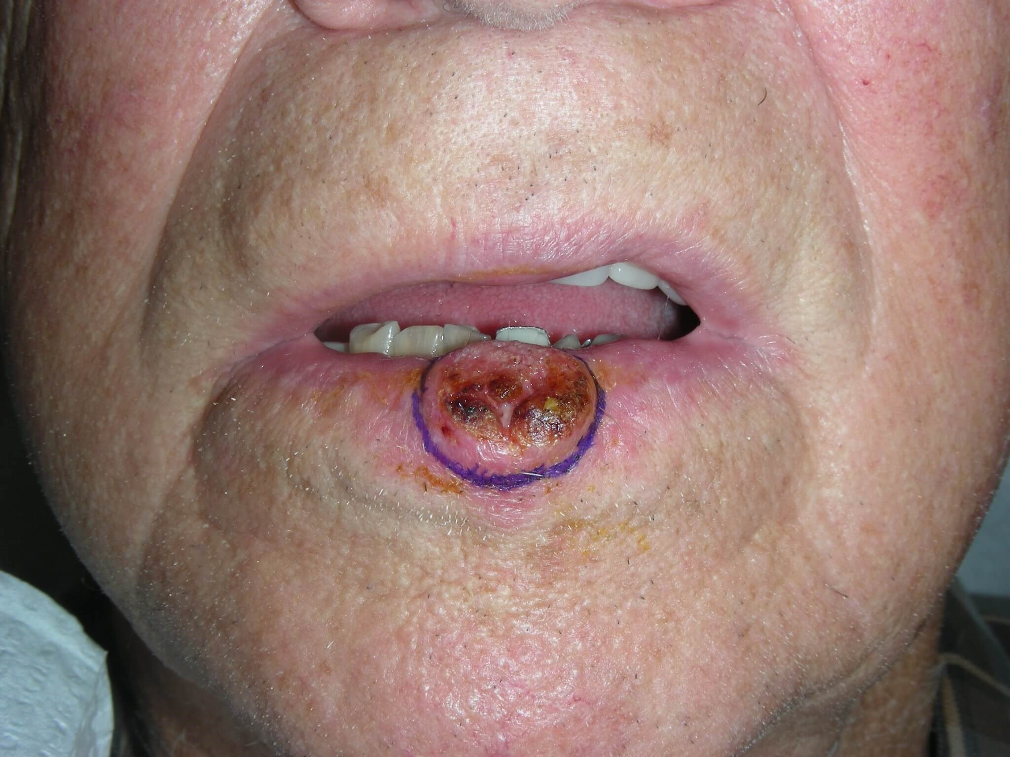 Before Image