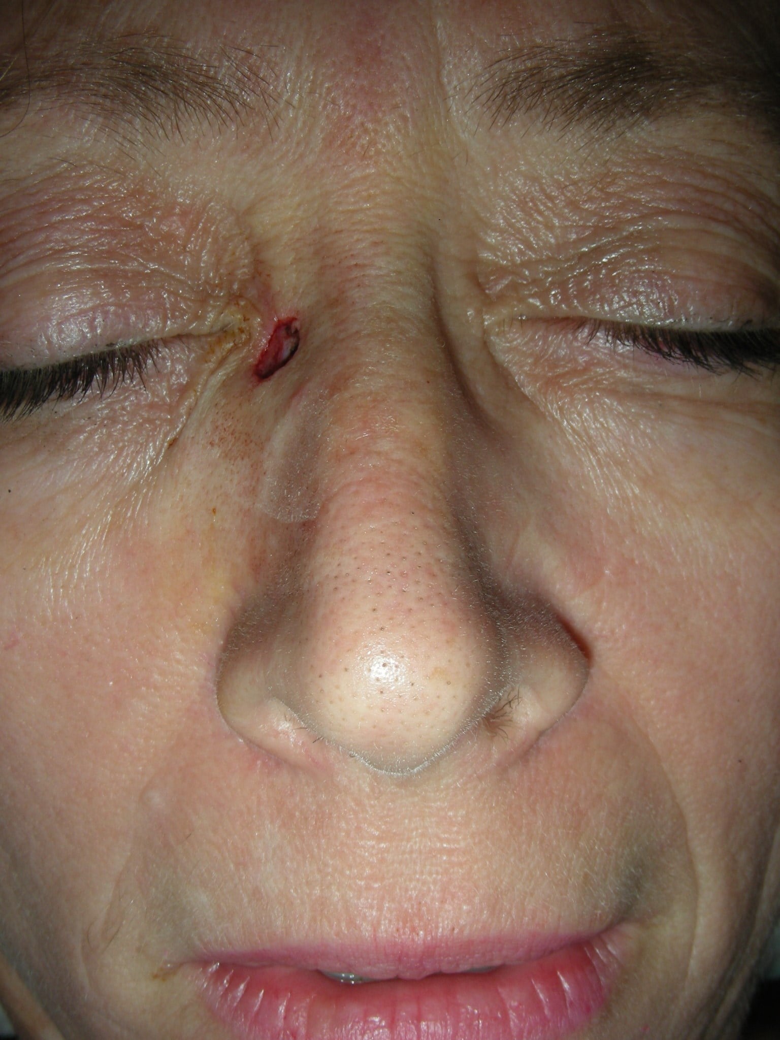 Before Image