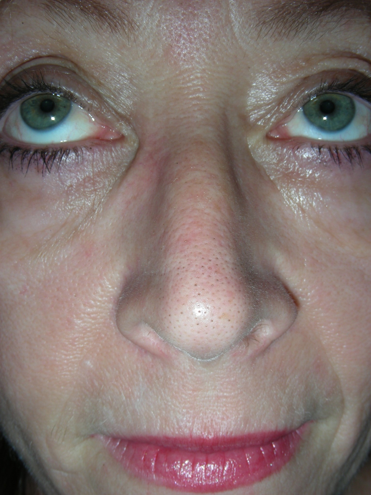 After Image