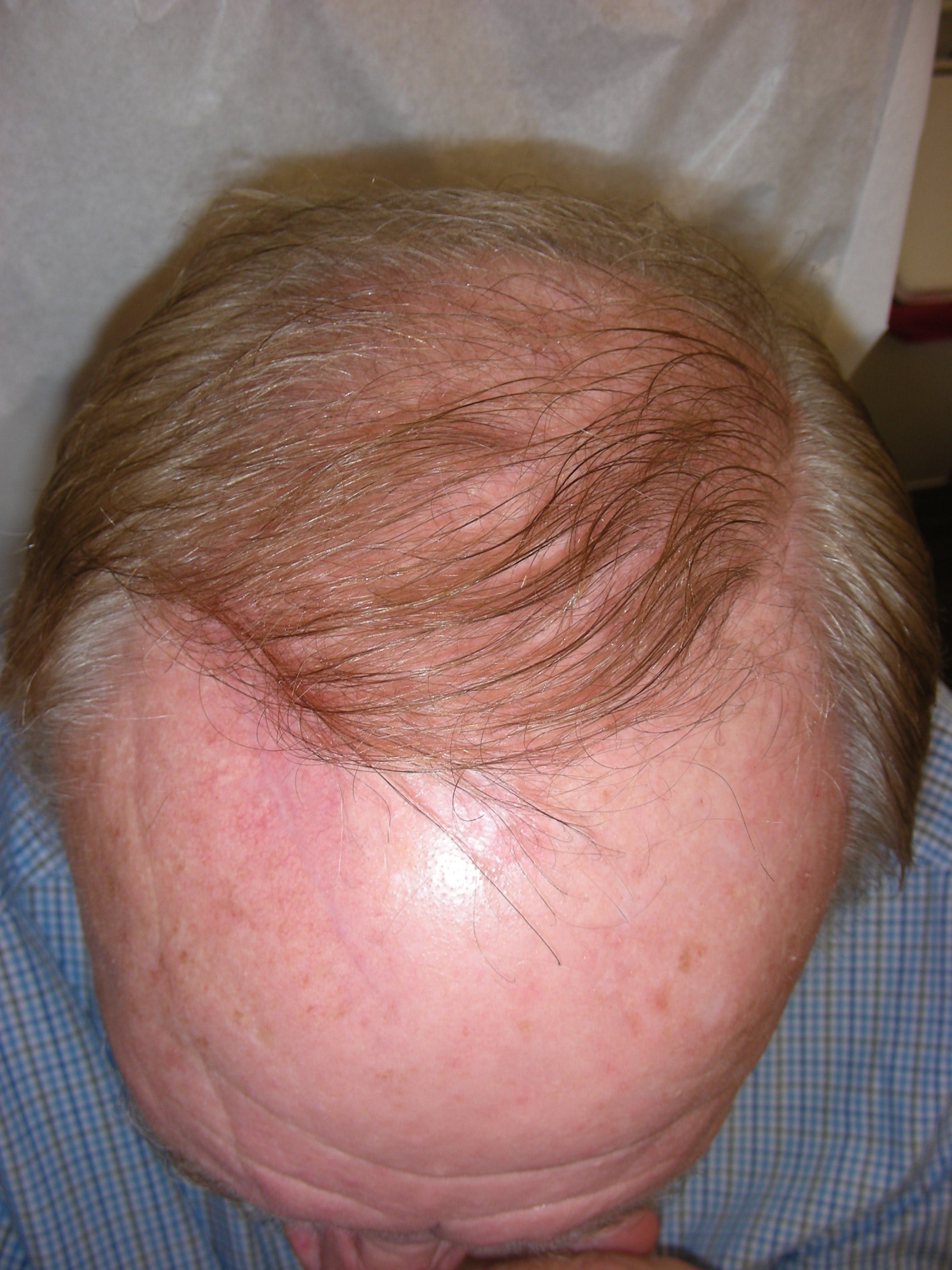 After Image