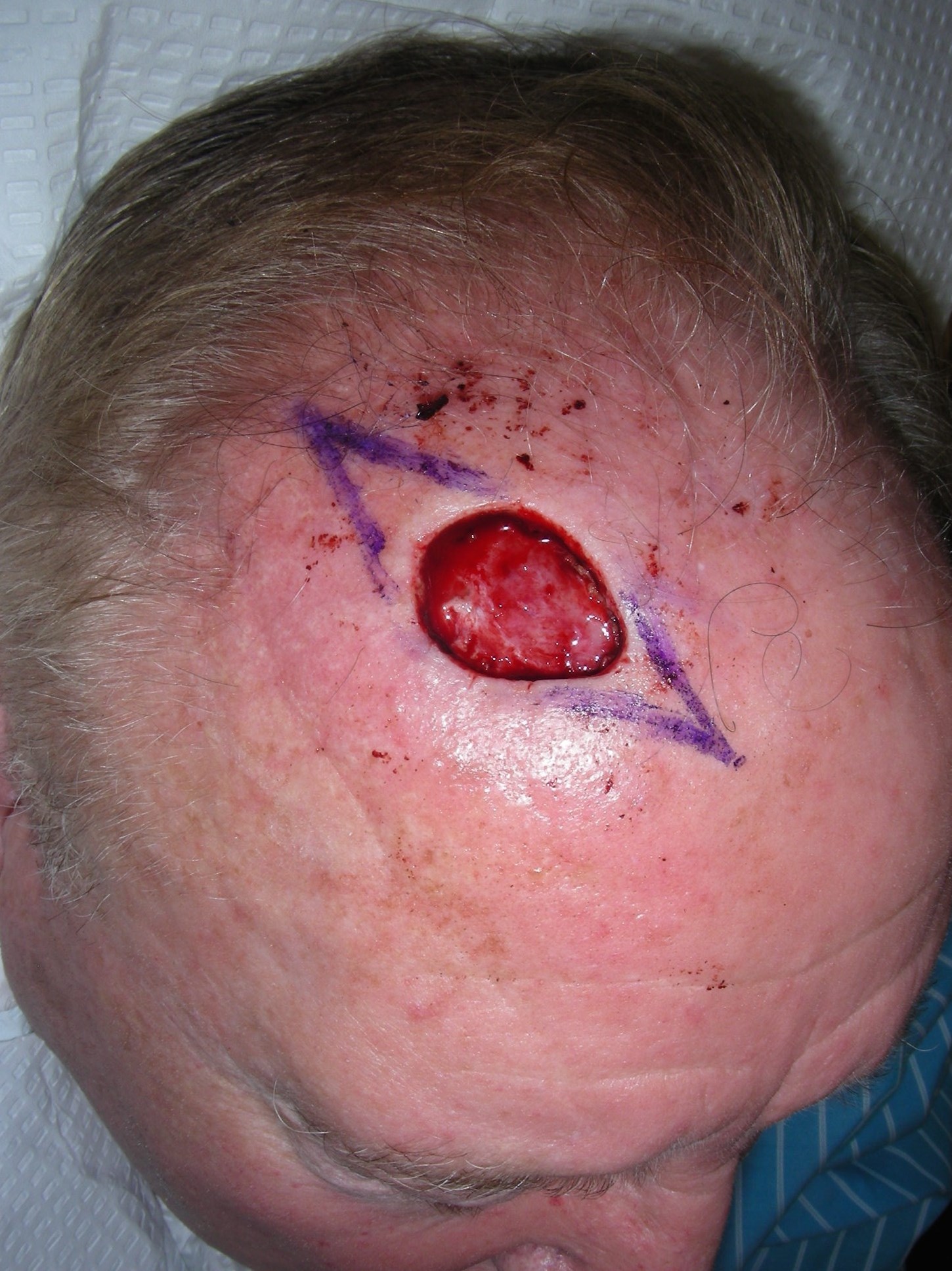 Why is the scar so long? Before