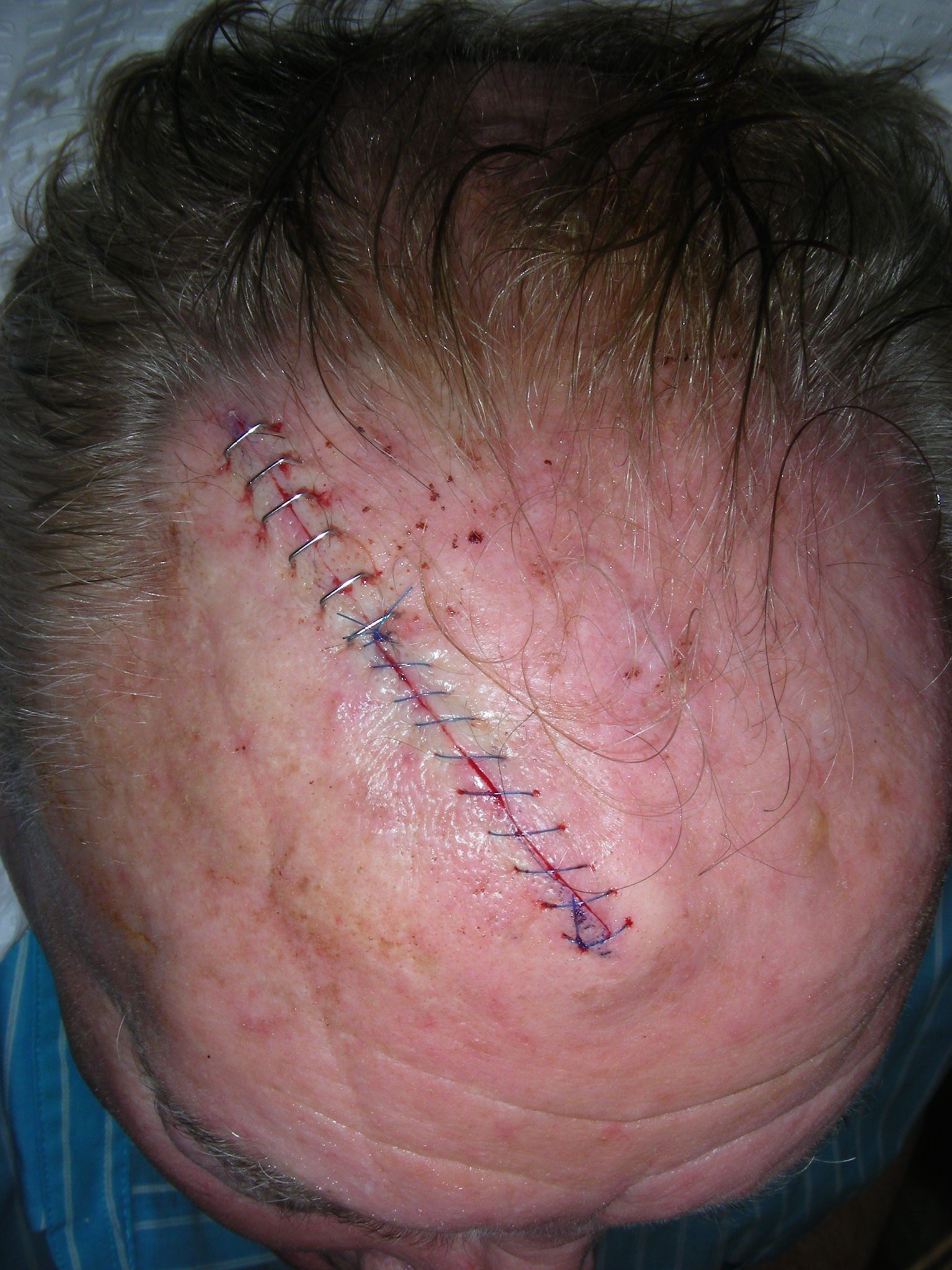 Why is the scar so long? After