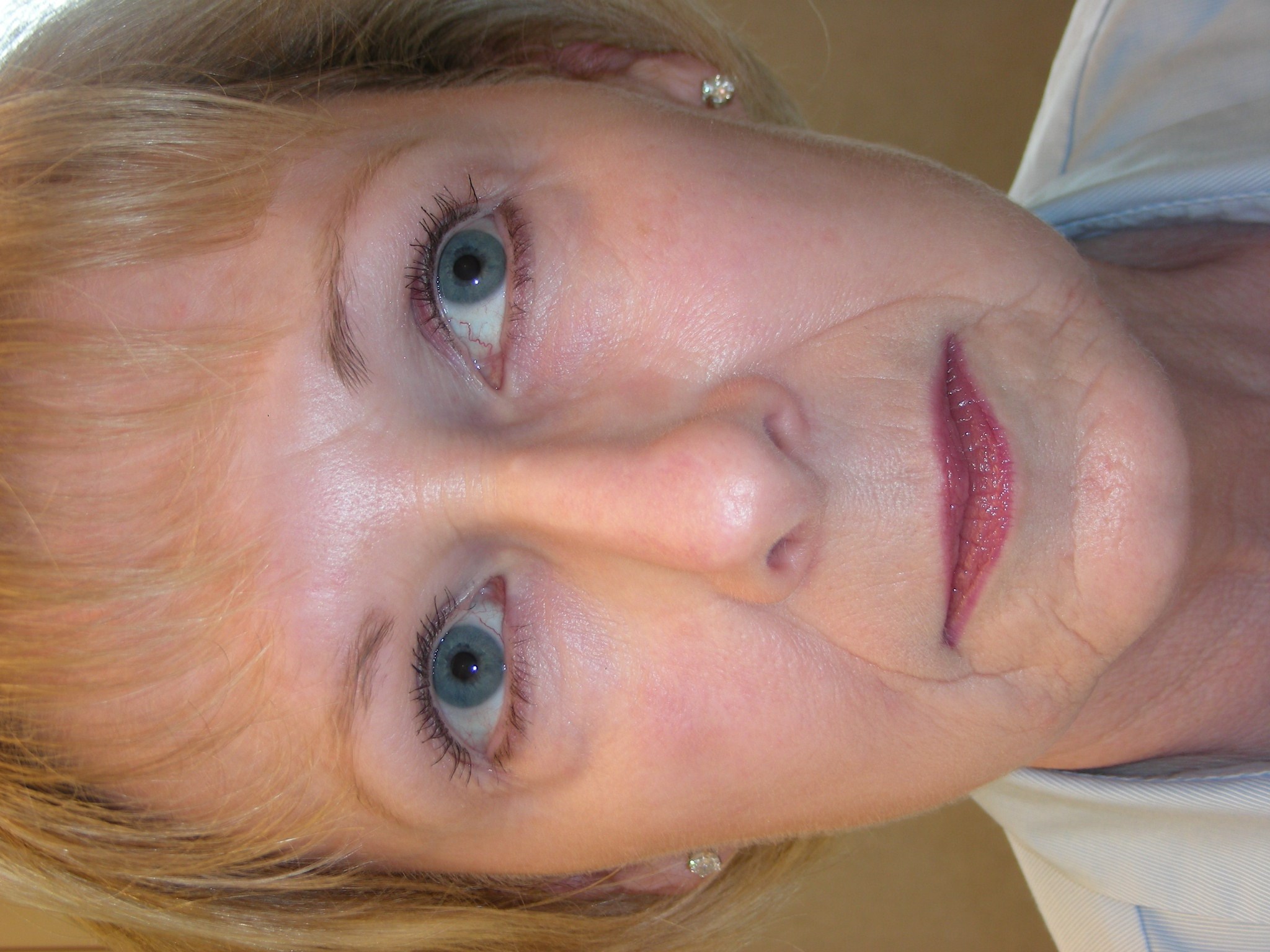 Before and After Basal Cell Carcinoma & Reconstructive Plastic Surgery