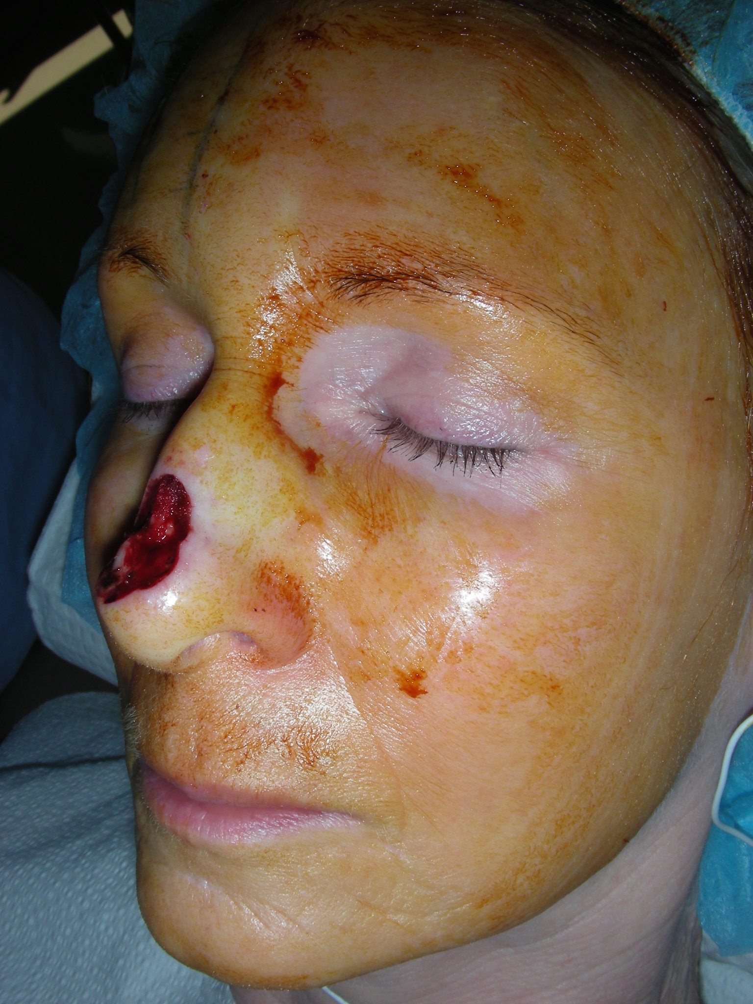 More photos from surgery Before reconstruction