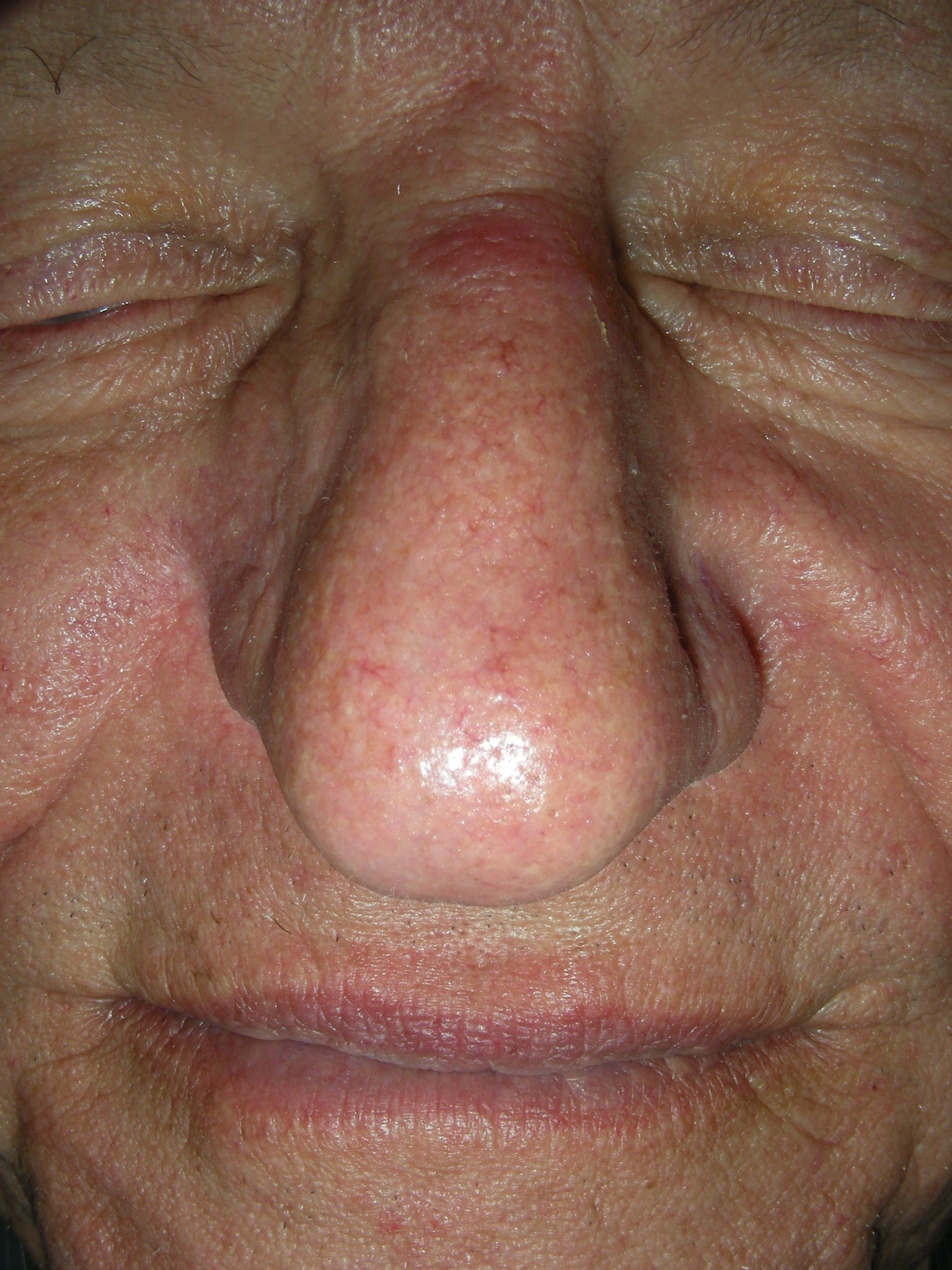 Good Symmetry After