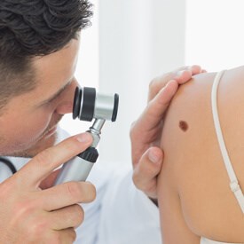 Melanoma
